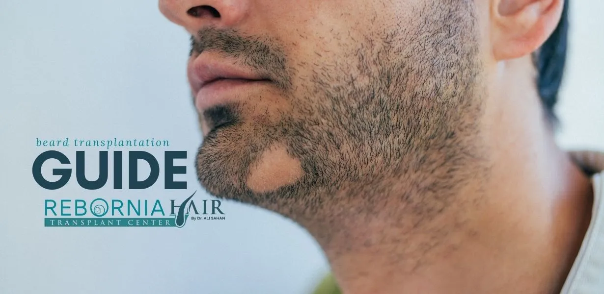 Beard Transplant Turkey: 2025 Guide to a Successful Transformation