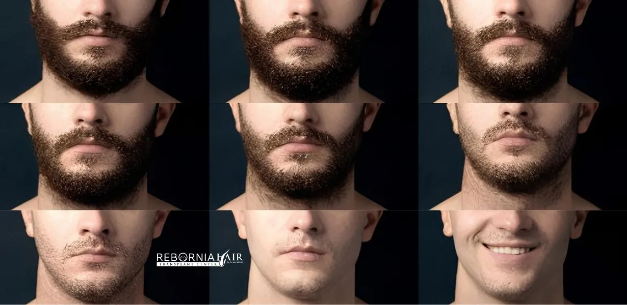 Will I Still Be Able To Shave After A Beard Transplant in Rebornia?